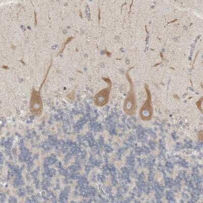 Immunohistochemistry-Paraffin: Sigma-1 R/OPRS1 Antibody [NBP1-82480]