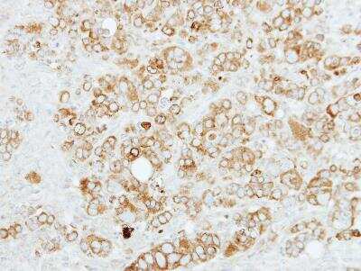 Immunohistochemistry-Paraffin: Sigma-1 R/OPRS1 Antibody [NBP2-19628]