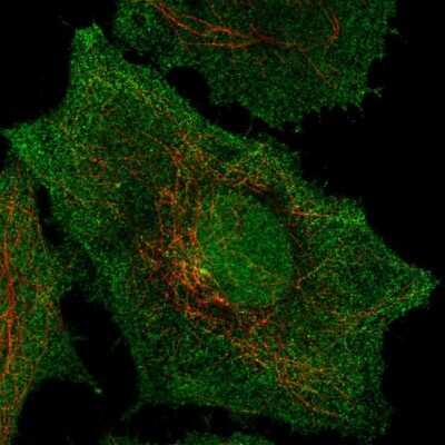 Immunocytochemistry/ Immunofluorescence: Signal peptide peptidase-like 2B Antibody [NBP2-55073]