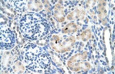 Immunohistochemistry-Paraffin: Signal peptide peptidase-like 2B Antibody [NBP1-59510]