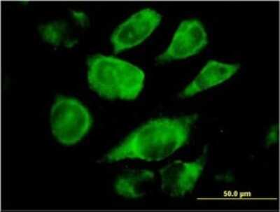 Immunocytochemistry/ Immunofluorescence: Signal sequence receptor delta Antibody (2D3) [H00006748-M01]