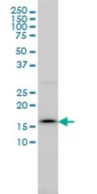 Western Blot: Signal sequence receptor delta Antibody (2D3) [H00006748-M01]
