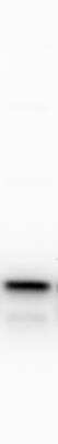 Western Blot: Signal sequence receptor delta Antibody [NBP1-92390]