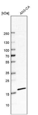 Western Blot: Signal sequence receptor delta Antibody [NBP1-92390]