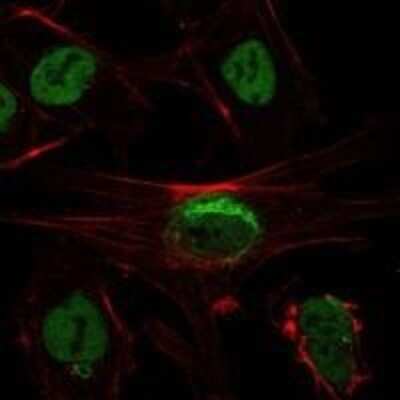 Immunocytochemistry/ Immunofluorescence: Sirtuin 1/SIRT1 Antibody (1F3) - Azide and BSA Free [NBP2-80949]