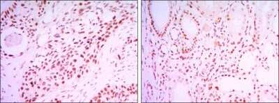 Immunohistochemistry: Sirtuin 1/SIRT1 Antibody (1F3) - Azide and BSA Free [NBP2-80949]