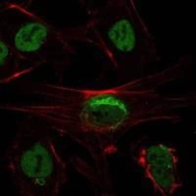 Immunocytochemistry/ Immunofluorescence: Sirtuin 1/SIRT1 Antibody (1F3) - BSA Free [NBP1-51641]