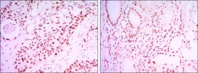 Immunohistochemistry-Paraffin: Sirtuin 1/SIRT1 Antibody (1F3) - BSA Free [NBP1-51641]