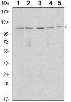 Western Blot: Sirtuin 1/SIRT1 Antibody (1F3)BSA Free [NBP1-51641]