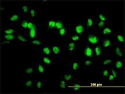 Immunocytochemistry/ Immunofluorescence: Sirtuin 1/SIRT1 Antibody (7B7) [H00023411-M01]