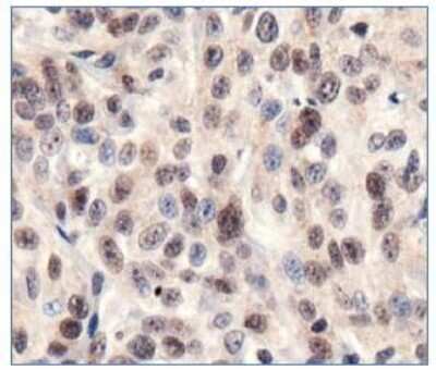 Immunohistochemistry: Sirtuin 1/SIRT1 Antibody [NBP1-49540]
