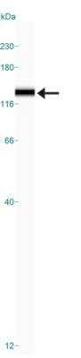 Simple Western: Sirtuin 1/SIRT1 Antibody [NBP1-49540]