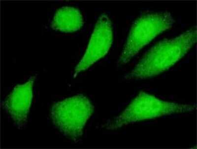 Immunocytochemistry/ Immunofluorescence: Sirtuin 2/SIRT2 Antibody (4B11) [H00022933-M01]
