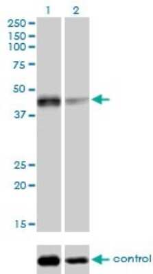 Western Blot: Sirtuin 2/SIRT2 Antibody (4B11) [H00022933-M01]