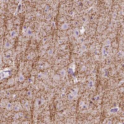 Immunohistochemistry-Paraffin: Sirtuin 2/SIRT2 Antibody [NBP1-87039]