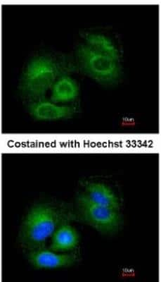 Immunocytochemistry/ Immunofluorescence: Sirtuin 3/SIRT3 Antibody [NBP1-31029]