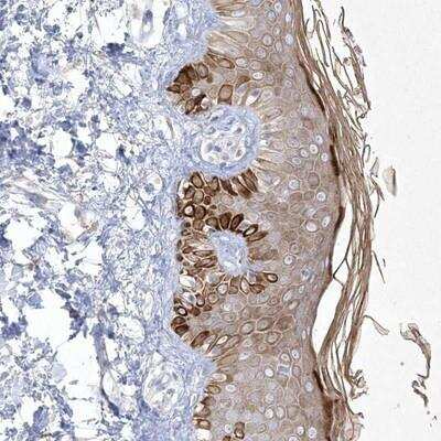 Immunohistochemistry-Paraffin: Sirtuin 3/SIRT3 Antibody [NBP1-87037]