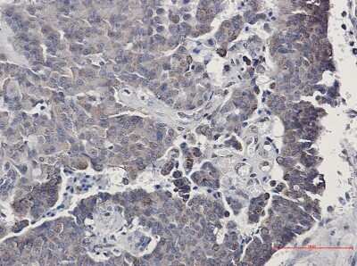 Immunohistochemistry-Paraffin: Sirtuin 3/SIRT3 Antibody (S03-1F5) [NBP3-15091]