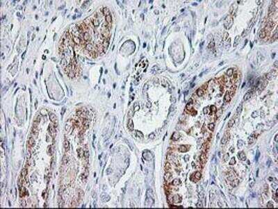 Immunohistochemistry-Paraffin: Sirtuin 5/SIRT5 Antibody (OTI2F1) [NBP2-01003]