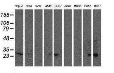 Western Blot: Sirtuin 5/SIRT5 Antibody (OTI2F1) [NBP2-01003]