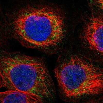 Immunocytochemistry/ Immunofluorescence: Sirtuin 5/SIRT5 Antibody [NBP1-89535]
