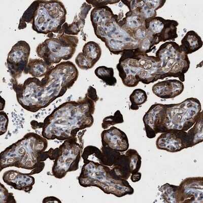 Immunohistochemistry-Paraffin: Sirtuin 5/SIRT5 Antibody [NBP1-86004]