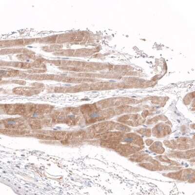 Immunohistochemistry-Paraffin: Sirtuin 5/SIRT5 Antibody [NBP1-86013]