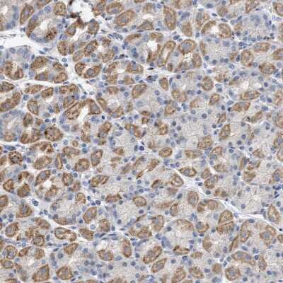 Immunohistochemistry-Paraffin: Sirtuin 5/SIRT5 Antibody [NBP1-86013]