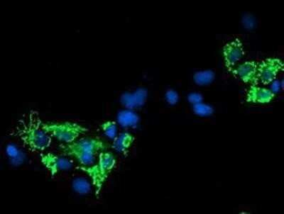 Immunocytochemistry/ Immunofluorescence: Sirtuin 5/SIRT5 Antibody (OTI2F1) - Azide and BSA Free [NBP2-74199]