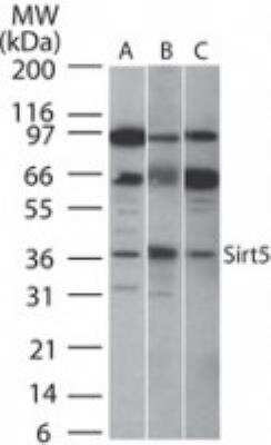 Western Blot: Sirtuin 5/SIRT5 Antibody [NB100-56372]