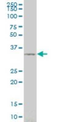 Western Blot: SIX3 Antibody (3F1) [H00006496-M02]
