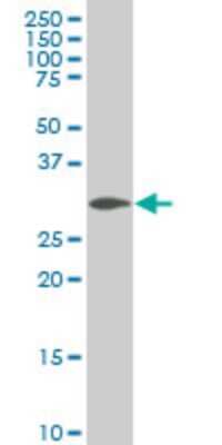 Western Blot: SIX3 Antibody (3F1) [H00006496-M02]