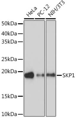 Western Blot: Skp1 Antibody (10G5X5) [NBP3-16734]