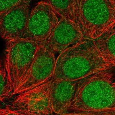 Immunocytochemistry/ Immunofluorescence: Skp1 Antibody [NBP2-56707]
