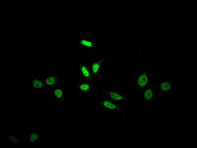 Immunocytochemistry/ Immunofluorescence: Skp2 Antibody (3C11) [NBP3-15197]