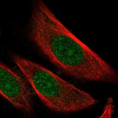 Immunocytochemistry/ Immunofluorescence: Skp2 Antibody [NBP2-56192]
