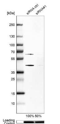 Western Blot: Skp2 Antibody [NBP2-56192]