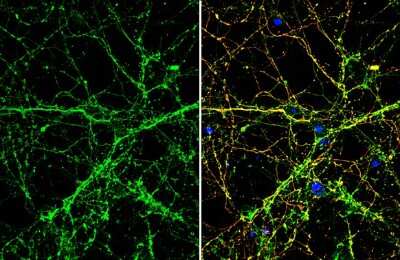 Immunocytochemistry/ Immunofluorescence: Slit1 Antibody [NBP3-13365]