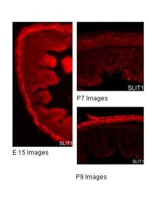 Immunohistochemistry: Slit1 Antibody [NBP2-84269]