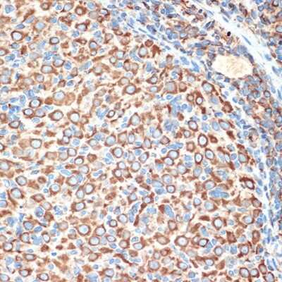 Immunohistochemistry-Paraffin: Slit2 Antibody (1T5A3) [NBP3-16194]