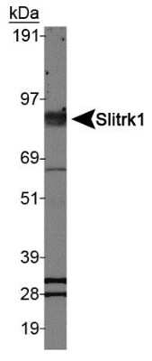 Western Blot: SLITRK1 AntibodyBSA Free [NBP1-49541]
