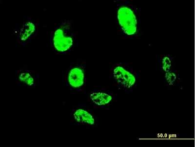 Immunocytochemistry/ Immunofluorescence: Slug Antibody (3C12) [H00006591-M05]