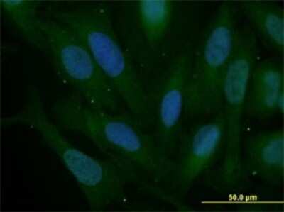 Immunocytochemistry/ Immunofluorescence: Slug Antibody (3C12) [H00006591-M05]