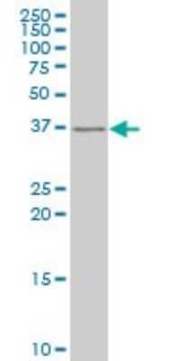 Western Blot: Slug Antibody (3C12) [H00006591-M05]