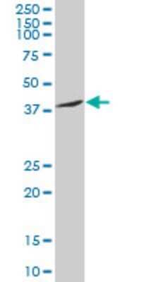 Western Blot: Slug Antibody (3C12) [H00006591-M05]