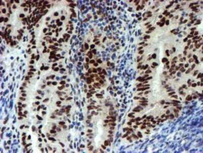 Immunohistochemistry: Slug Antibody (OTI1A6) - Azide and BSA Free [NBP2-74229]