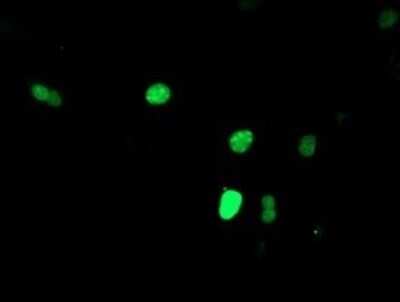 Immunocytochemistry/ Immunofluorescence: Slug Antibody (OTI2B11) - Azide and BSA Free [NBP2-74235]