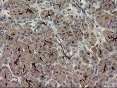 Immunohistochemistry: Slug Antibody (OTI2B11) - Azide and BSA Free [NBP2-74235]