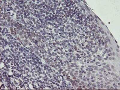 Immunohistochemistry: Slug Antibody (OTI2B11) - Azide and BSA Free [NBP2-74235]