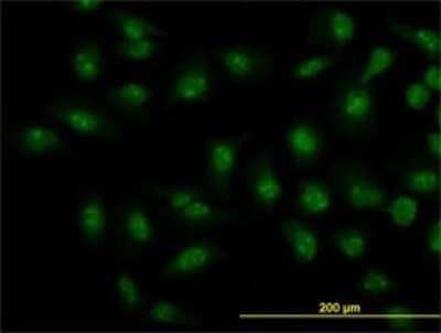 Immunocytochemistry/ Immunofluorescence: Smad1 Antibody (2A1) [H00004086-M04]